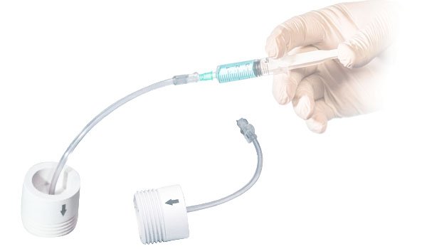 Cleaning and disinfecting the 24 or 36 channels of the High Resolution Manometry Catheter
