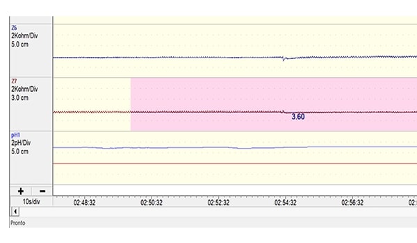 Nightly Basal Average - MNBI