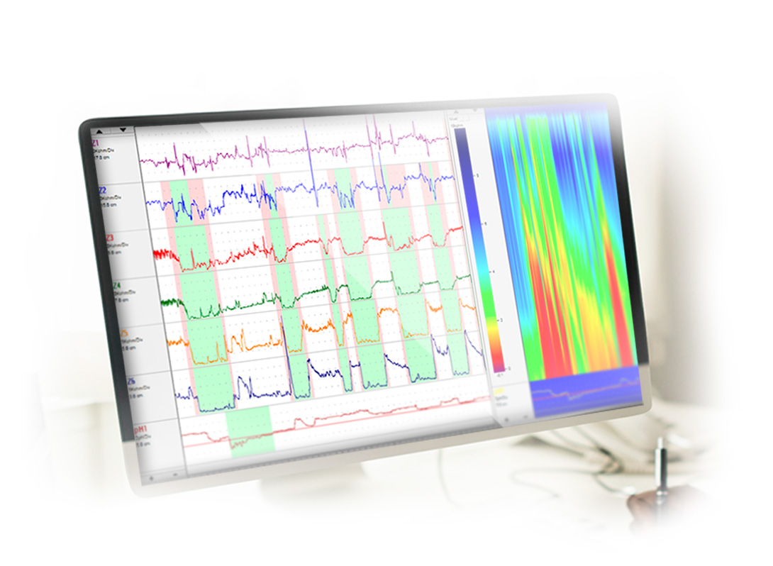 Practical pHmetry and Impedance-pHmetry - AL-4  Z-pH